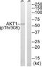 Protein kinase B antibody, TA313262, Origene, Western Blot image 