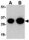 Protein NipSnap homolog 1 antibody, GTX85407, GeneTex, Western Blot image 