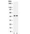 Angiotensin II type-1 receptor antibody, R32059, NSJ Bioreagents, Western Blot image 