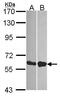 DDX19B antibody, GTX115612, GeneTex, Western Blot image 