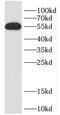 Cell Division Cycle 20 antibody, FNab01518, FineTest, Western Blot image 