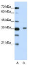 BTB Domain Containing 6 antibody, TA345479, Origene, Western Blot image 