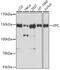 p125 antibody, GTX55845, GeneTex, Western Blot image 
