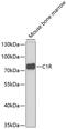 Complement C1r subcomponent antibody, GTX33049, GeneTex, Western Blot image 