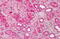 Paired Immunoglobin Like Type 2 Receptor Beta antibody, MBS247388, MyBioSource, Immunohistochemistry paraffin image 