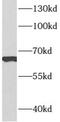 Armadillo Repeat Containing X-Linked 2 antibody, FNab00589, FineTest, Western Blot image 