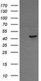 Calreticulin 3 antibody, TA505837, Origene, Western Blot image 