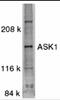 Mitogen-Activated Protein Kinase Kinase Kinase 5 antibody, 1151, ProSci, Western Blot image 