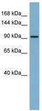 Retinoic Acid Induced 14 antibody, TA333808, Origene, Western Blot image 