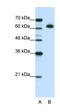 DIS3 Like 3'-5' Exoribonuclease 2 antibody, orb324938, Biorbyt, Western Blot image 
