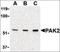 P21 (RAC1) Activated Kinase 2 antibody, orb87340, Biorbyt, Western Blot image 