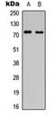 Solute Carrier Family 6 Member 16 antibody, orb304591, Biorbyt, Western Blot image 