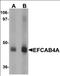 Calcium Release Activated Channel Regulator 2B antibody, orb94597, Biorbyt, Western Blot image 