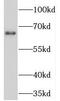 Neuroepithelial Cell Transforming 1 antibody, FNab05665, FineTest, Western Blot image 