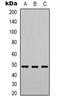 Proteasome 26S Subunit, ATPase 3 antibody, orb318794, Biorbyt, Western Blot image 