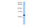 LOC391524 antibody, 26-572, ProSci, Enzyme Linked Immunosorbent Assay image 