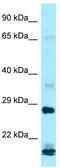 Interferon Alpha 16 antibody, TA343039, Origene, Western Blot image 