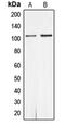 Androgen Receptor antibody, MBS820707, MyBioSource, Western Blot image 