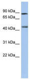 Retinoic Acid Receptor Gamma antibody, TA336210, Origene, Western Blot image 