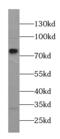 Cytosolic carboxypeptidase-like protein 5 antibody, FNab00208, FineTest, Western Blot image 