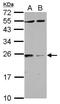 Tyrosine 3-Monooxygenase/Tryptophan 5-Monooxygenase Activation Protein Zeta antibody, GTX114140, GeneTex, Western Blot image 