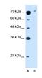 Solute Carrier Family 7 Member 14 antibody, orb325119, Biorbyt, Western Blot image 