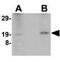 Nanos C2HC-Type Zinc Finger 2 antibody, GTX85392, GeneTex, Western Blot image 
