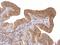 Roundabout Guidance Receptor 1 antibody, GTX114103, GeneTex, Immunohistochemistry paraffin image 