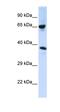 Alpha Tubulin Acetyltransferase 1 antibody, orb325027, Biorbyt, Western Blot image 
