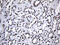 Splicing Factor 3b Subunit 6 antibody, M10990, Boster Biological Technology, Immunohistochemistry paraffin image 