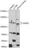 Ectonucleotide Pyrophosphatase/Phosphodiesterase 2 antibody, GTX32462, GeneTex, Western Blot image 