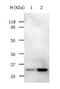 RAB5A, Member RAS Oncogene Family antibody, TA321627, Origene, Western Blot image 