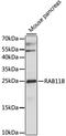 Ras-related protein Rab-11B antibody, LS-C750322, Lifespan Biosciences, Western Blot image 