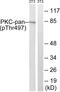 PKC antibody, PA5-38418, Invitrogen Antibodies, Western Blot image 