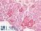 60S ribosomal protein L3 antibody, LS-C333041, Lifespan Biosciences, Immunohistochemistry paraffin image 