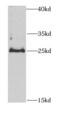 Carbonyl Reductase 4 antibody, FNab01326, FineTest, Western Blot image 