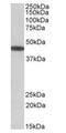 Pre-B-cell leukemia transcription factor 1 antibody, orb20593, Biorbyt, Western Blot image 