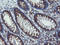 Acyl-CoA Binding Domain Containing 3 antibody, LS-C174032, Lifespan Biosciences, Immunohistochemistry paraffin image 