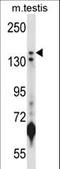 Lysine Demethylase 5B antibody, LS-C165353, Lifespan Biosciences, Western Blot image 