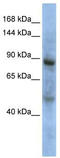 Zinc Fingers And Homeoboxes 3 antibody, TA344507, Origene, Western Blot image 