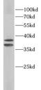 Protein Kinase AMP-Activated Non-Catalytic Subunit Gamma 1 antibody, FNab10337, FineTest, Western Blot image 