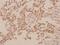 Cadherin 15 antibody, A10888, Boster Biological Technology, Immunohistochemistry paraffin image 