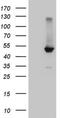 Nuclear Receptor Subfamily 1 Group H Member 4 antibody, NBP2-46221, Novus Biologicals, Western Blot image 