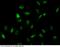 HMG1 antibody, 10326-MM10, Sino Biological, Immunohistochemistry paraffin image 