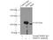 MMS19 nucleotide excision repair protein homolog antibody, 66049-1-Ig, Proteintech Group, Immunoprecipitation image 