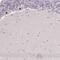 Kelch Repeat And BTB Domain Containing 6 antibody, PA5-61355, Invitrogen Antibodies, Immunohistochemistry frozen image 