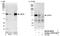 Ubiquitin Specific Peptidase 38 antibody, NB100-40833, Novus Biologicals, Western Blot image 