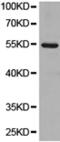 Gamma-Glutamyltransferase 1 antibody, TA323391, Origene, Western Blot image 