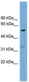 Radical S-Adenosyl Methionine Domain Containing 1 antibody, TA344874, Origene, Western Blot image 