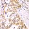 Acyl-CoA Dehydrogenase Short Chain antibody, LS-C346294, Lifespan Biosciences, Immunohistochemistry paraffin image 